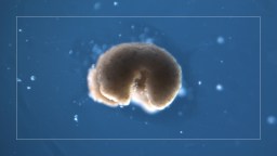 An image of a xenobot